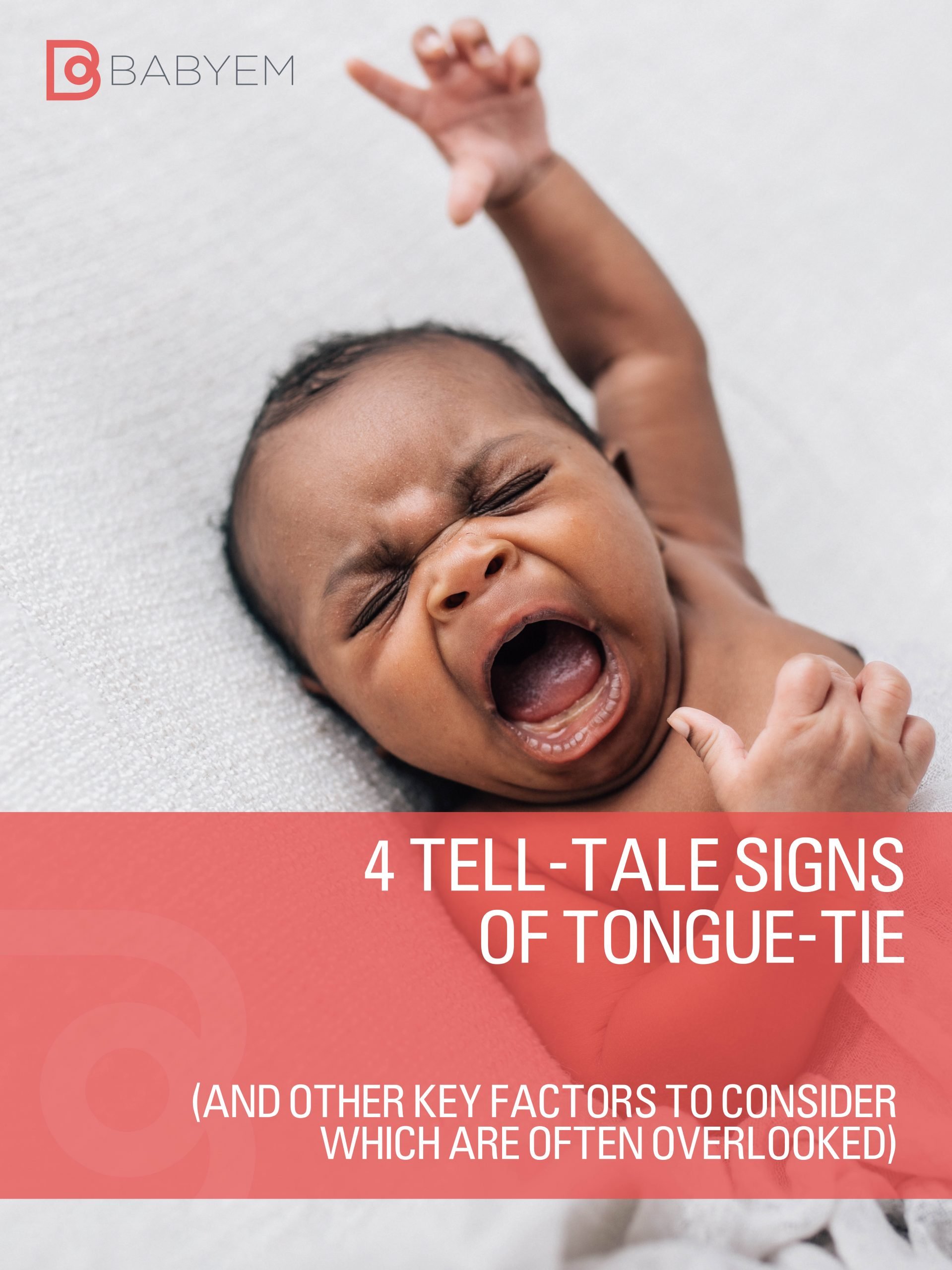 tongue tie guide